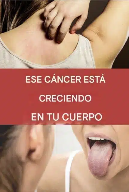 19 señales de advertencia de que el cáncer está creciendo en su cuerpo