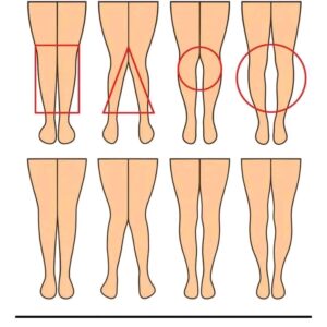 LAS PIERNAS DE UNA MUJER PUEDEN DECIR CÓMO ES