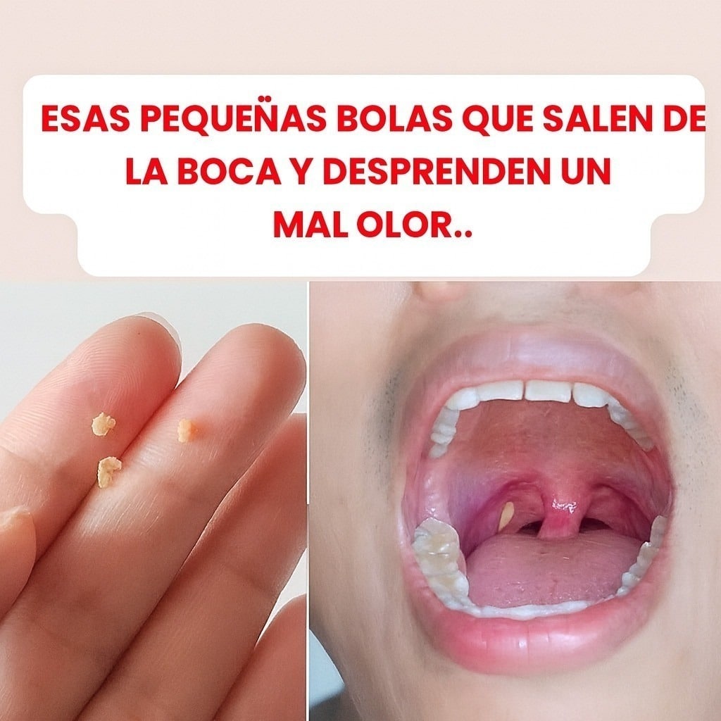 Mal aliento: un remedio casero para recuperar un aliento fresco hoy
