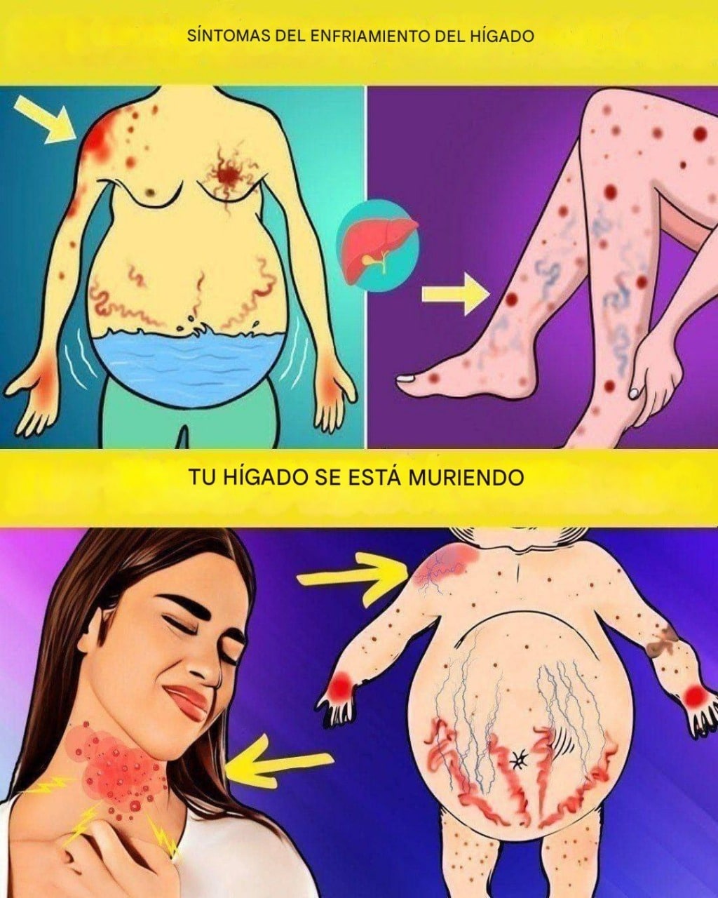17 señales de que algo anda mal con tu hígado para cuidarte