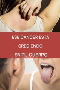 19 señales de advertencia de que el cáncer está creciendo en su cuerpo
