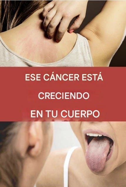 19 señales de alerta del cáncer en el cuerpo
