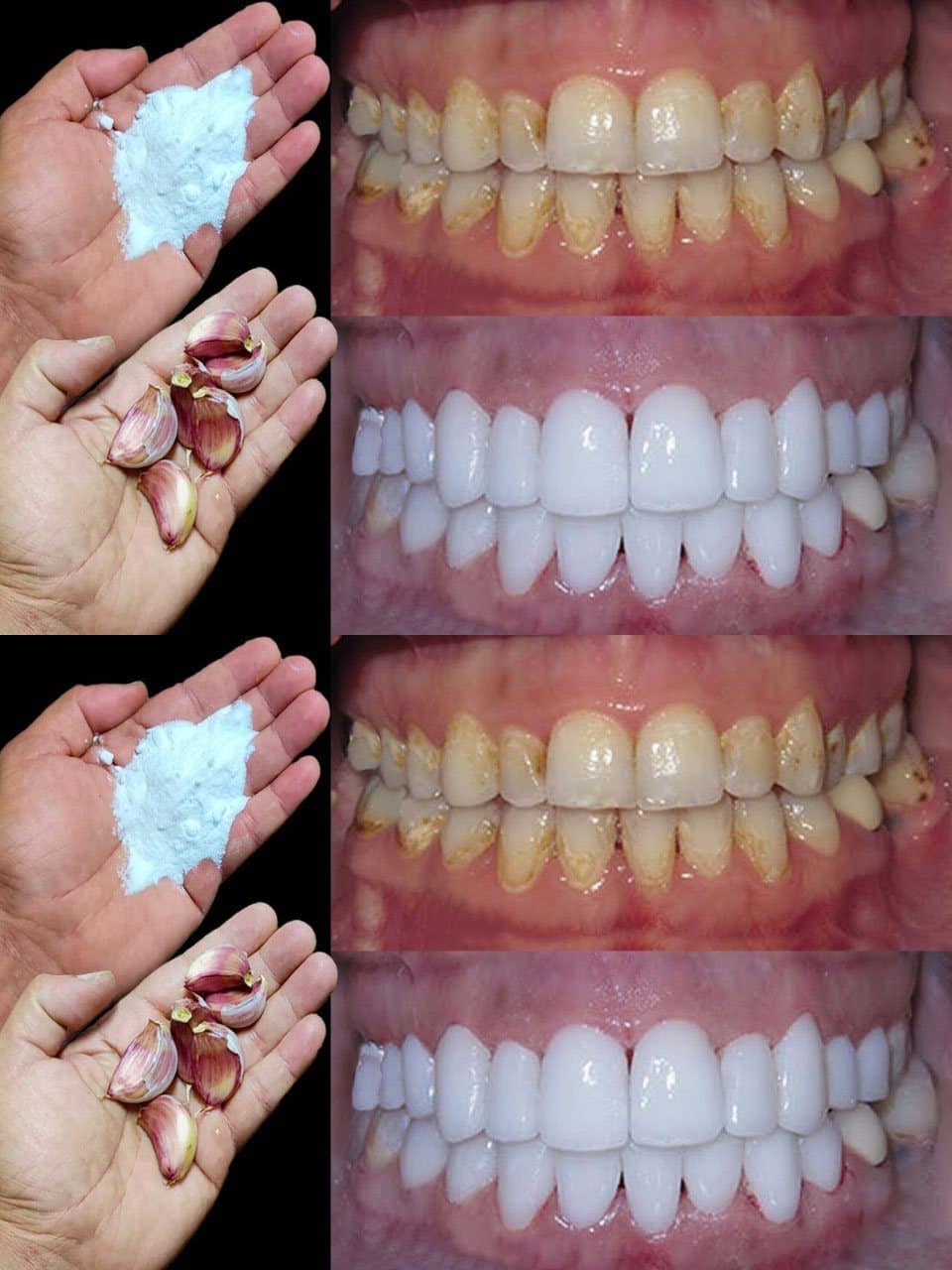 Aprende cómo blanquear los dientes en dos minutos hoy
