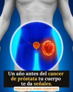 Cáncer de próstata