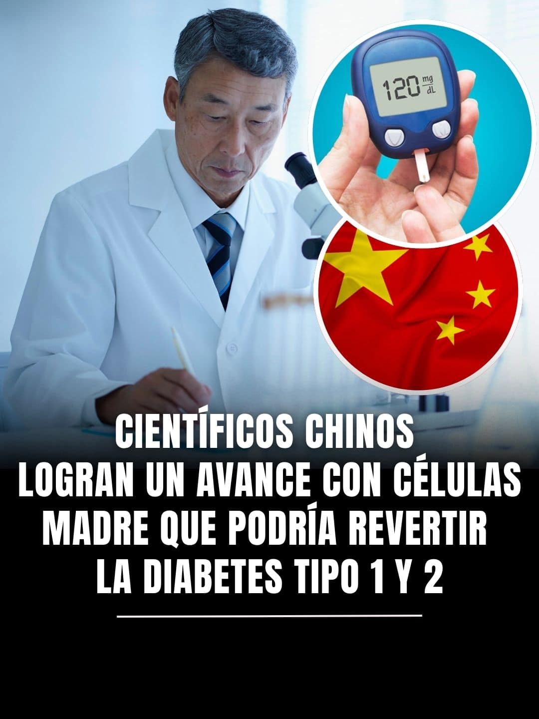 Células madre para la diabetes: científicos en China revierten la enfermedad