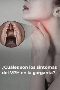 Cuáles son los síntomas del VPH en la garganta