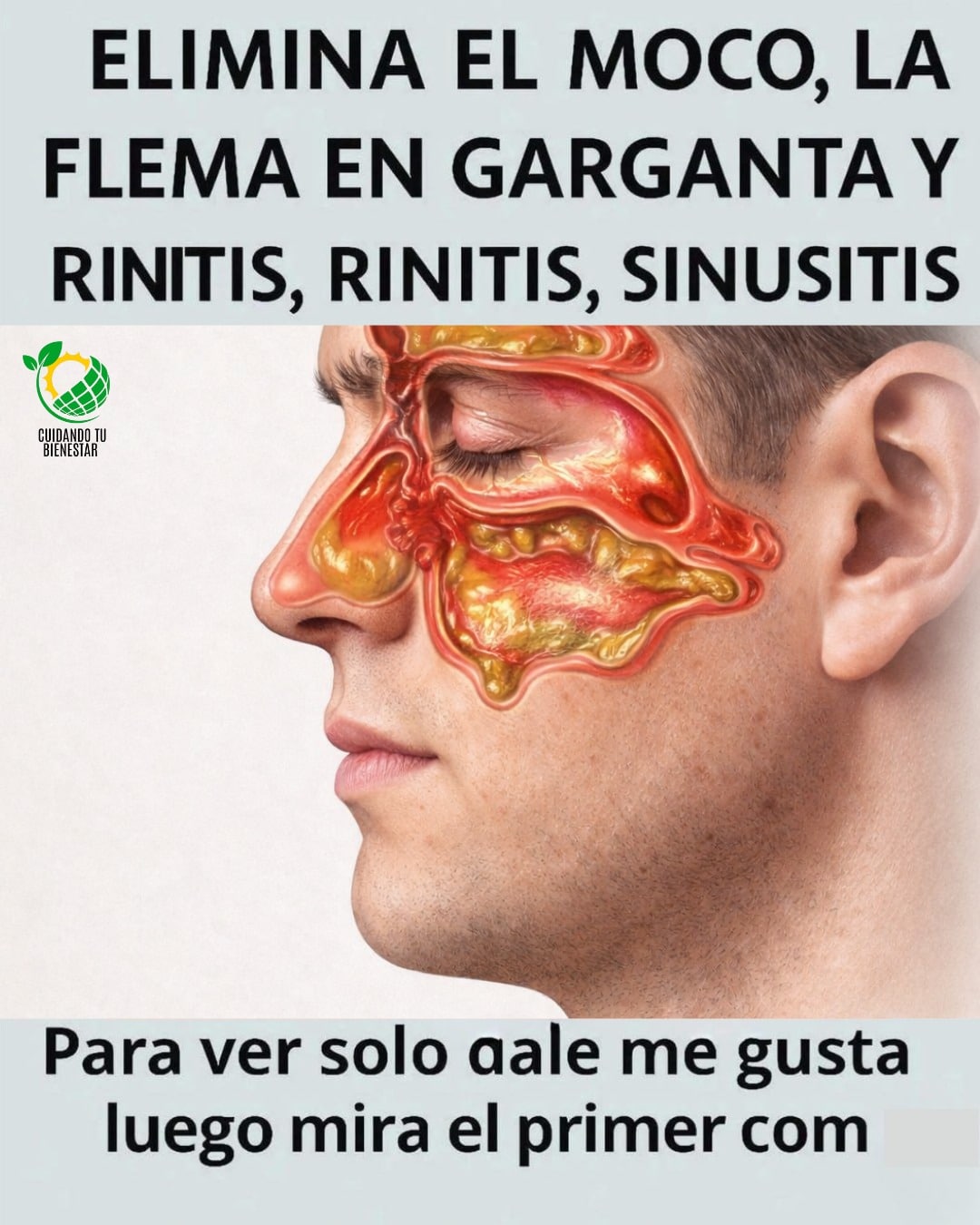 Elimina el moco, la flema en la garganta y la rinitis