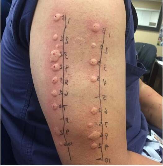 Estas son las consecuencias de acostarse con