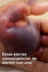 Esto es lo que puede pasar cuando duermes con una