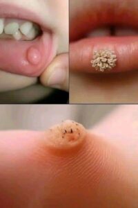 Estos son los primeros signos de un enf