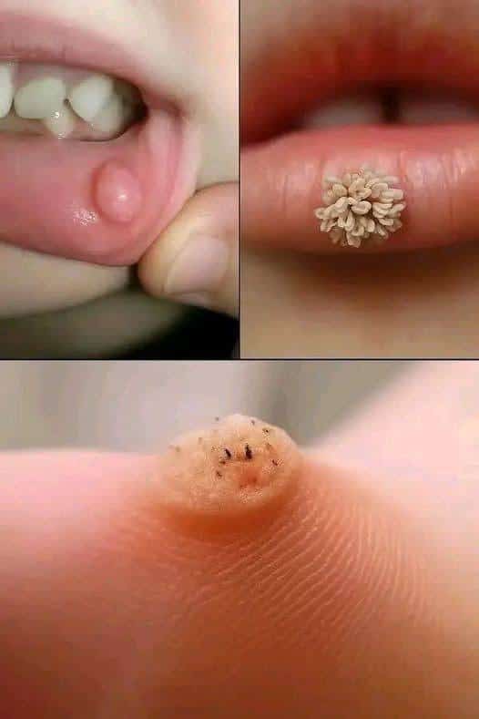 Cómo reconocer estos son los primeros signos de un enf cutáneo