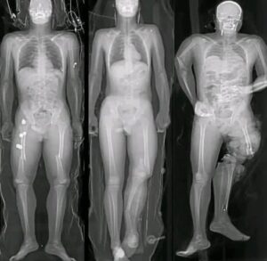 Lo que debes saber si te pusiste la vacuna