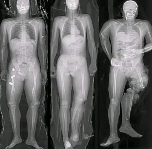 Importante: Lo que debes saber si te pusiste la vacuna