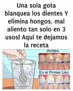 Quita el sarro de tus dientes y blanquéalos