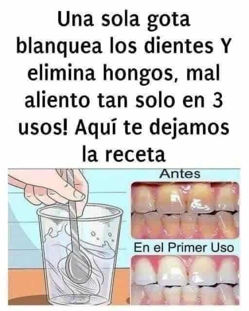 Cómo quita el sarro de tus dientes y blanquéalos con éxito