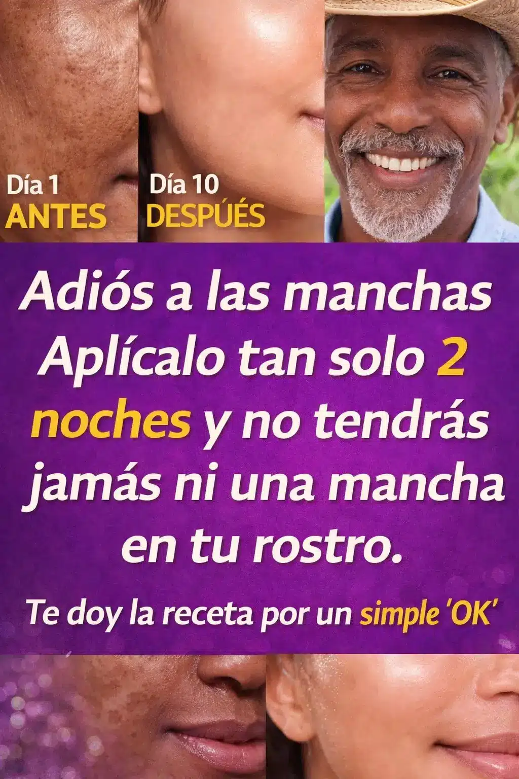 Remedio natural contra manchas faciales en 2 noches